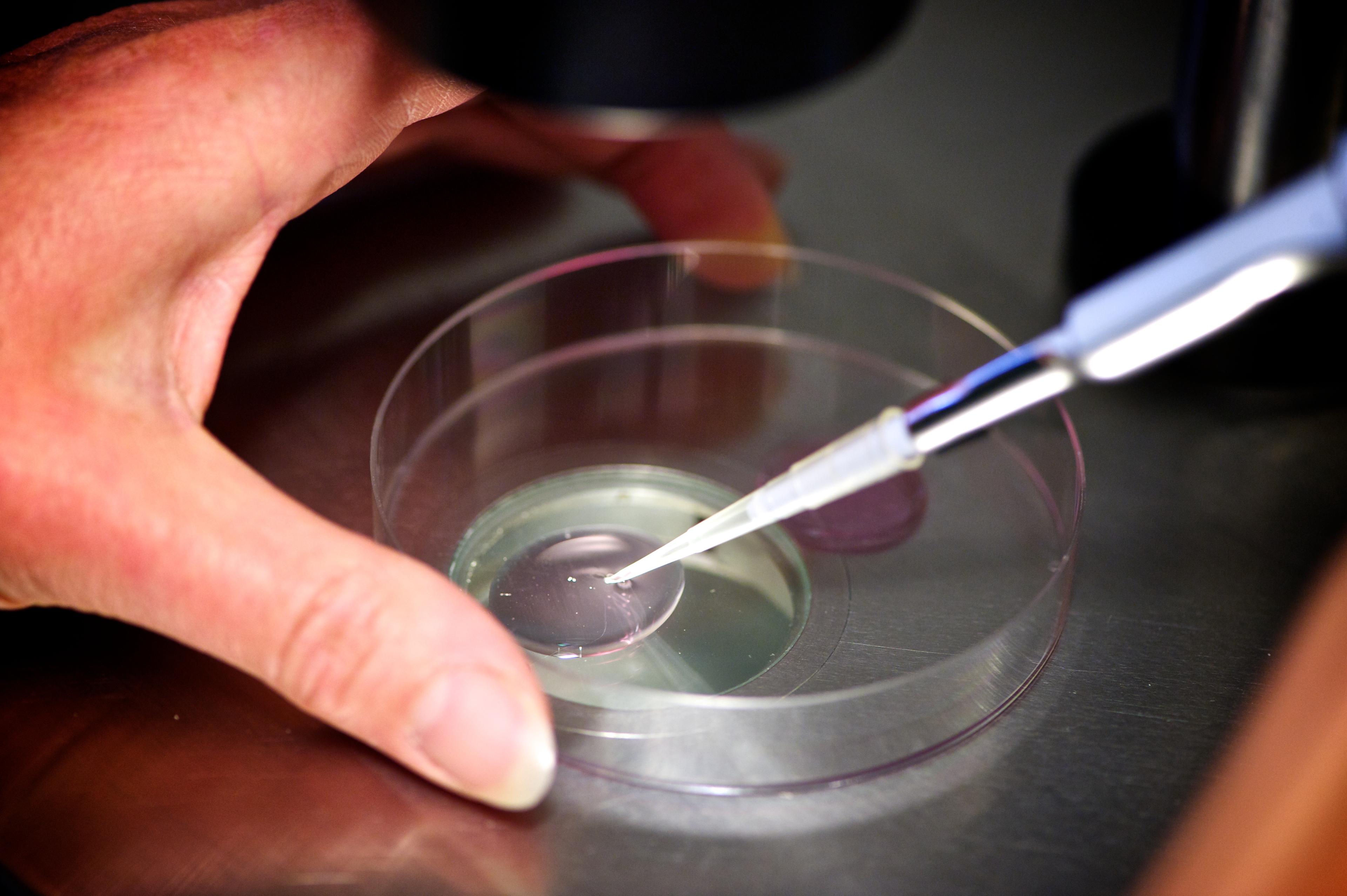 Ivf (Photo By BSIP/UIG Via Getty Images)